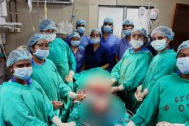 Ambedkar Hospital successfully performs unique secondary abdominal pregnancy operation, both mother and baby are safe hindi News latest News big News khabargali 