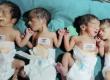 The woman gave birth to four children at once, a son and three daughters.