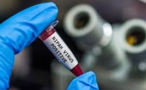 भारत में Nipah Virus अलर्ट, पश्चिम बंगाल में नर्स की मौत से हड़कंप, देशभर में अलर्ट और सख्त निगरानी खबरगली Nipah virus alert in India, death of nurse in West Bengal causes panic, nationwide alert and strict monitoring hindi news latest news khabargali 