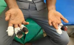 Accident at ITI Doondilhora: Student loses 5 fingers after being hit by a machine big news latest hindi news khabargali 