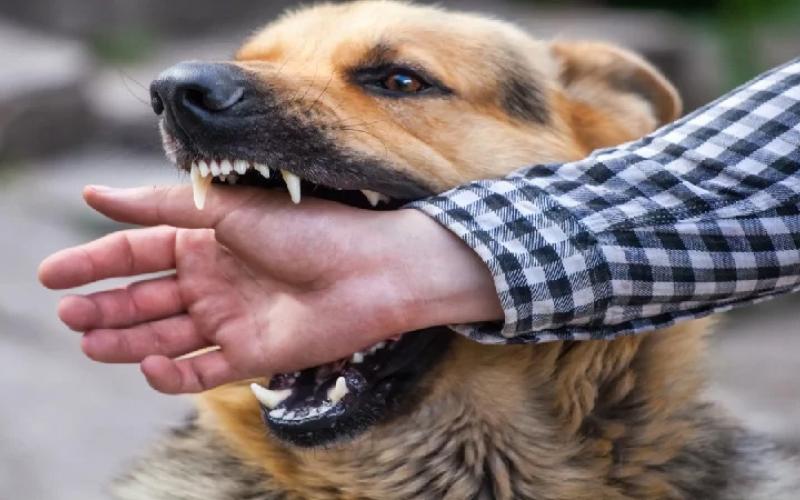 If dog bites, compensation fixed at Rs 10,000 for each tooth mark, if flesh is scratched, double compensation... 1.6 crore cases of dog bites registered in India in 3 years, rabies, news,khabargali