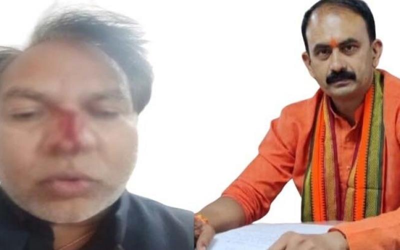 BJP councilor Rohit Sahu and BJP slum cell district president Om Rathod fight over road tender, Rathod suffers serious nose injury, Raipur, Chhattisgarh, Khabargali