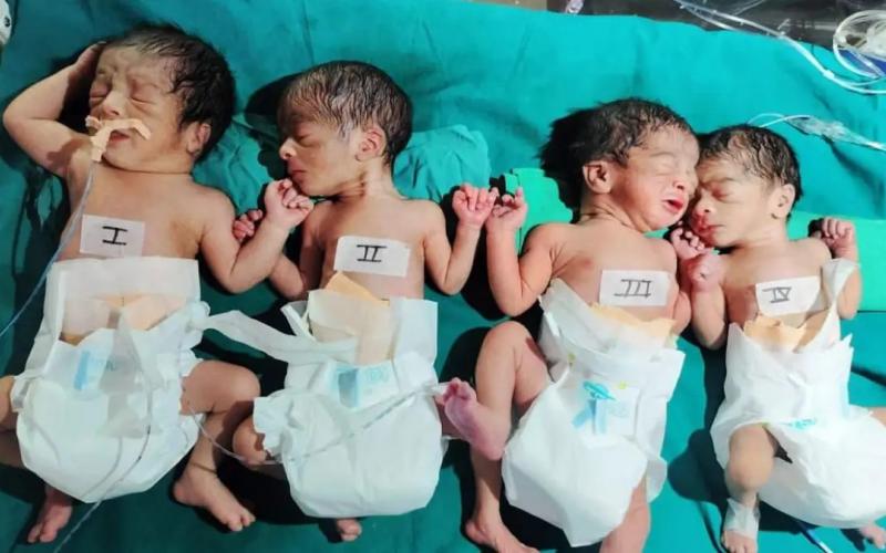 धमतरी में अनोखा मामला, एक महिला ने चार बच्चो को दिया जन्म खबरगली Unique case in Dhamtari, a woman gave birth to four children  cg news cg big news hindi news dhamatari news cg latest news khabargali 