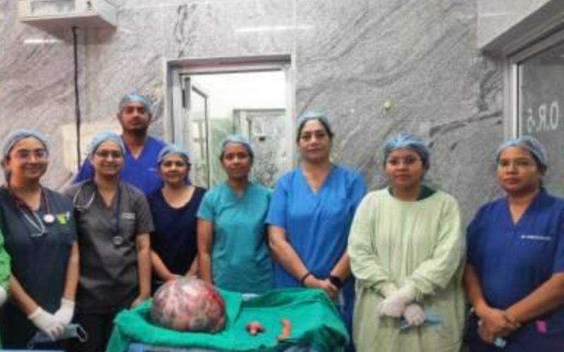 A 65-year-old woman was successfully operated upon at SIMS, a tumor weighing more than 10 kg was removed from her stomach cg news hindi News big news latest news khabargali 