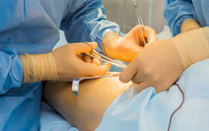 Negligence in Raipur hospital, operation was done on shoulder instead of neck, instructions to give Rs 5 lakh compensation to the family of the deceased cg news hindi news latest news khabargali 