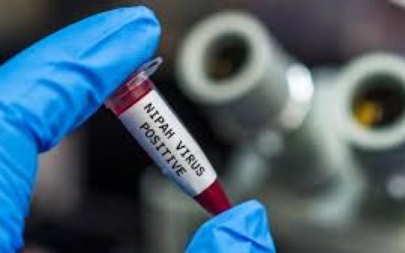 भारत में Nipah Virus अलर्ट, पश्चिम बंगाल में नर्स की मौत से हड़कंप, देशभर में अलर्ट और सख्त निगरानी खबरगली Nipah virus alert in India, death of nurse in West Bengal causes panic, nationwide alert and strict monitoring hindi news latest news khabargali 