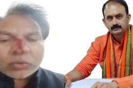 BJP councilor Rohit Sahu and BJP slum cell district president Om Rathod fight over road tender, Rathod suffers serious nose injury, Raipur, Chhattisgarh, Khabargali