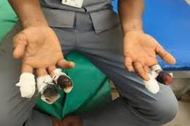 Accident at ITI Doondilhora: Student loses 5 fingers after being hit by a machine big news latest hindi news khabargali 