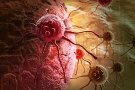 Chhattisgarh's new plan in the fight against cancer: patient database to be created, 5,000-bed 'Medicity' also ready. Latest news hindi news raipur news khabargali 