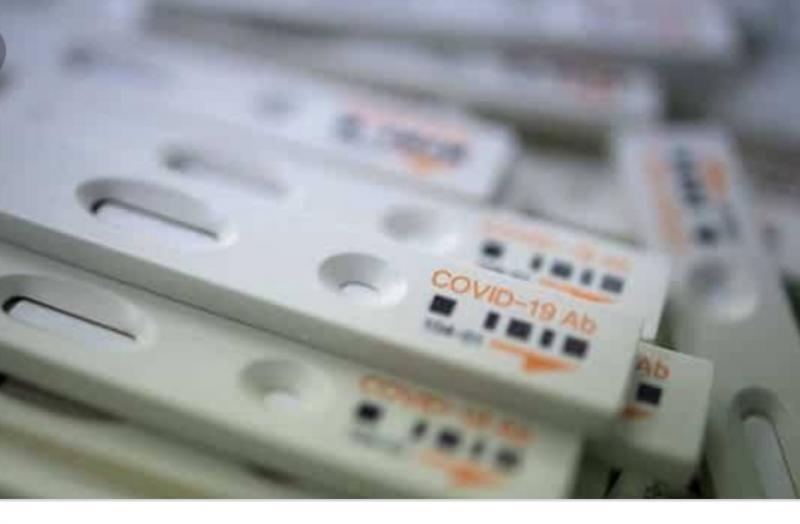 Covid-19 testing kits for corona , Commissioner of Health Department, Dr. C.R. Prasanna,Health Department , chhattisgarh, khabargali