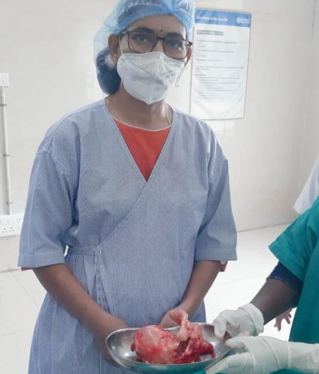 Stone Baby, Lithopedian, Fetal, Aesitis, Pt. Jawaharlal Nehru Memorial Medical College, Department of Gynecology and Obstetrics, Prof. Dr. Jyoti Jaiswal, uterus, abdomen, abdomen, womb, medical journal, sonography, Khabargali