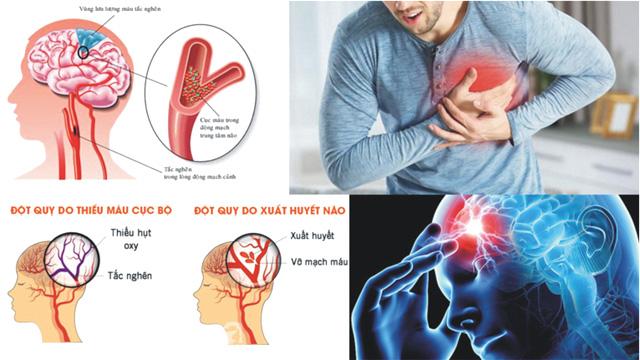 Paralysis, brain stroke, heart attack, Pharmaz has made this medicine called Tyvalzi, Sun Pharma will distribute it all over India, Khabargali