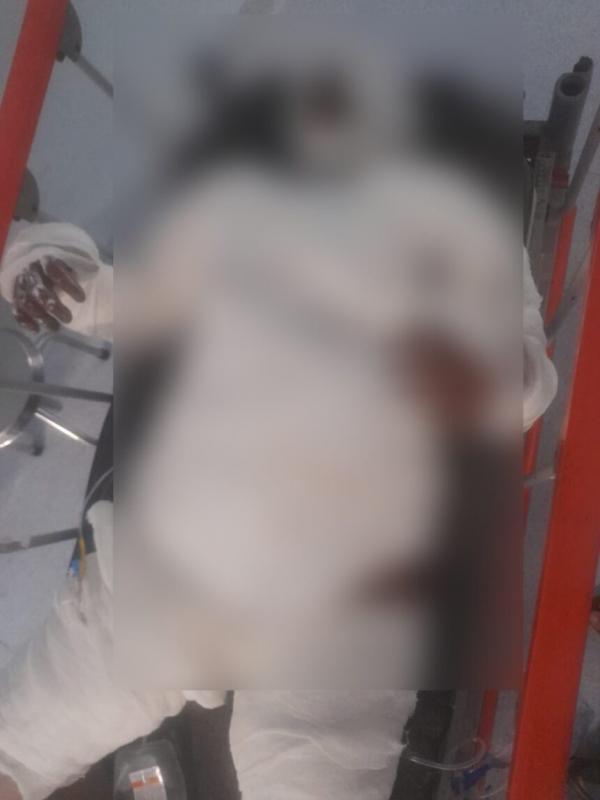A girl committed suicide by setting herself on fire at the railway station, RPF jawans took her to the hospital... Cg news big news hindi news khabargali 