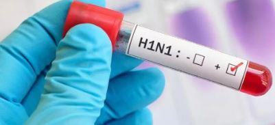 Swine flu hits the state, 2 women die, 7 new infected... latestnews hindinews cgnews bignews khabargali