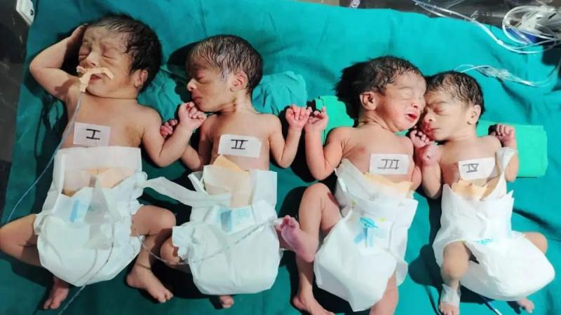 धमतरी में अनोखा मामला, एक महिला ने चार बच्चो को दिया जन्म खबरगली Unique case in Dhamtari, a woman gave birth to four children  cg news cg big news hindi news dhamatari news cg latest news khabargali 