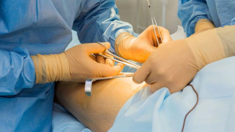 Negligence in Raipur hospital, operation was done on shoulder instead of neck, instructions to give Rs 5 lakh compensation to the family of the deceased cg news hindi news latest news khabargali 