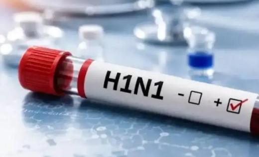 Swine flu outbreak intensifies in Chhattisgarh; over 80 patients reported in 3 days, with more than 50 active cases in Raipur. Hindi news latest news khabargali 